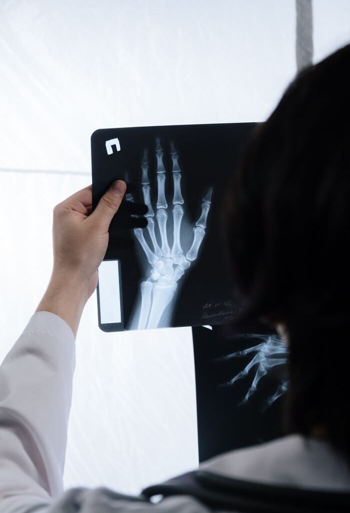 Doctor analyzing hand X-ray for signs of injury or bone health evaluation.